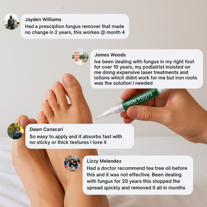 Iron Roots™ - Anti Fungal Toe Nail Gel